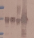 MDH4 | Malate dehydrogenase 4 (cytoplasmic) in the group Antibodies Plant/Algal / Carbohydrates at Agrisera AB (Antibodies for research) (AS15 3065)